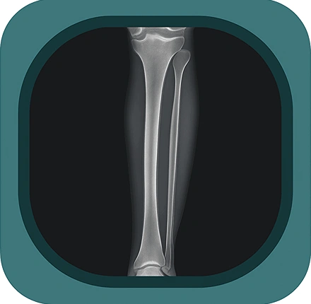 X ray lower leg anatomy icon